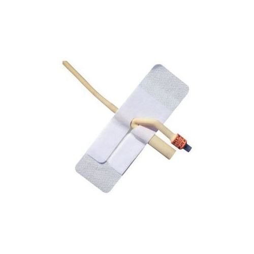 Avalon Air Adhesive Foley Catheter Anchoring Device 55AFA