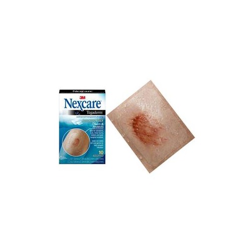 white christmas dresses Pharmacare Waterproof Sterile Adhesive Dressings 8cm x 10cm – McCabes  Pharmacy main image 0