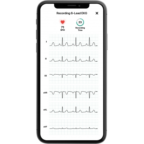 KardiaMobile EKG l Wireless EKG