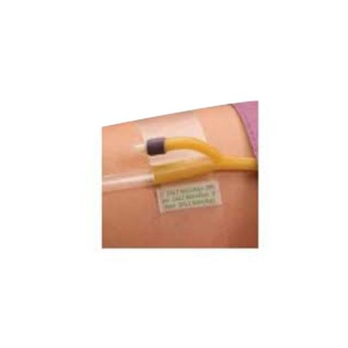 Dale Medical Products Inc Hold-n-Place Foley Catheter Holder Adhesive  Patch, One Size Fits All - DA150 