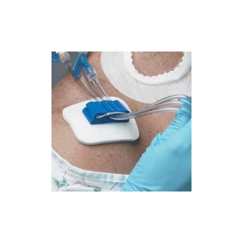 Medline Tubing Anchor Two Channels - EEANC52XT - Shoplet.com